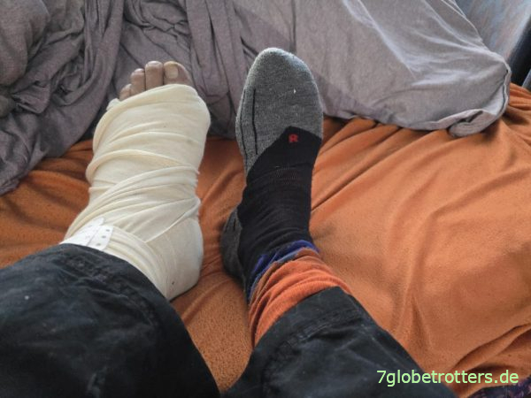 Fuß in Gips